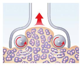 頑固なセルライトをもみ上げる！