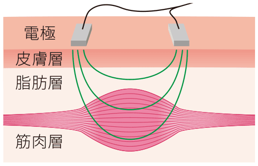EMSの低周波～高周波で効率よく筋肉運動・脂肪燃焼