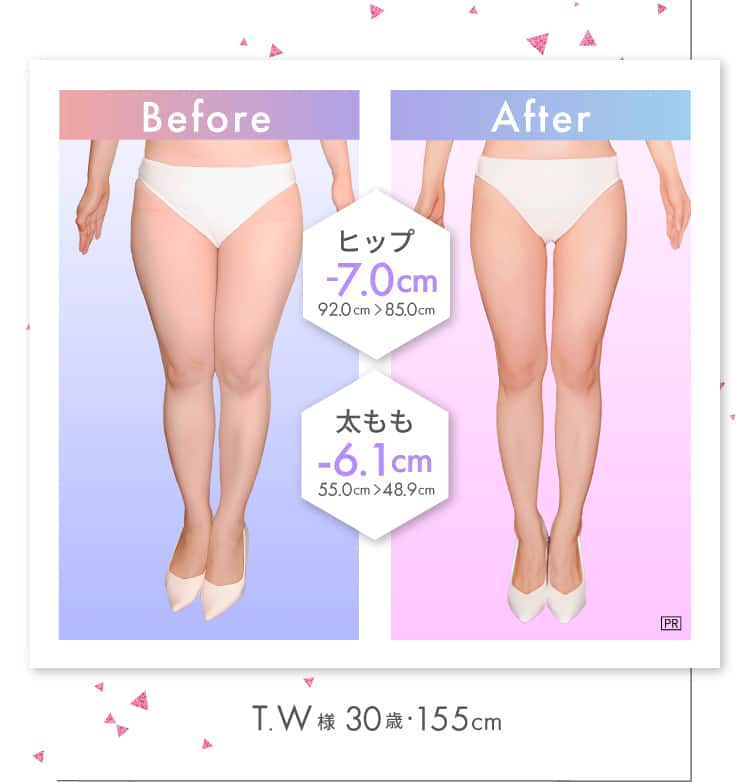 太もも -6.1cm！ T.W様（30歳・155cm）
Before-After ヒップ -7.0cm！ 92.0cm → 85.0cm 太もも -6.1cm！ 55.0cm → 48.9cm