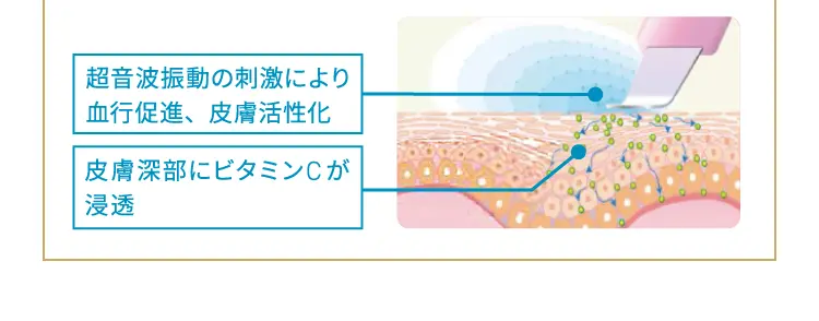 超音波振動の刺激により血行促進、皮膚活性化
        皮膚深部にビタミンCが浸透