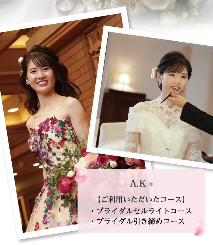 A.K様【ご利用いただいたコース】・ブライダルセルライトコース・ブライダル引き締めコース