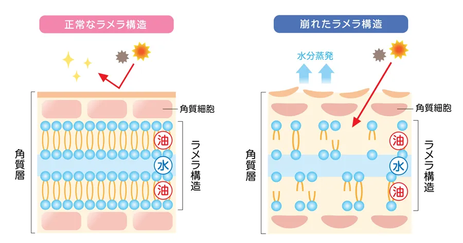 正常なラメラ構造と崩れたラメラ構造