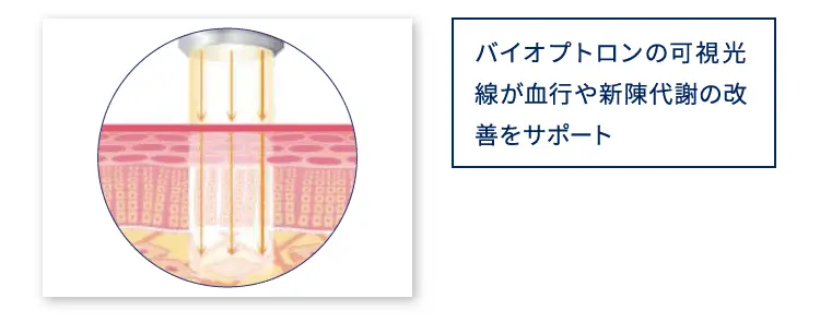 バイオプトロンの可視光線が血行や新陳代謝の改善をサポート