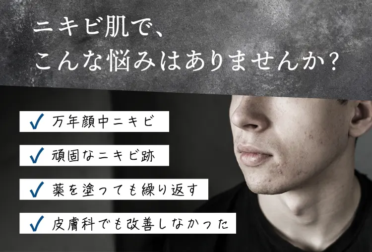 ニキビ肌で、こんな悩みはありますか？
        万年顔中ニキビ 頑固なニキビ跡 薬を塗っても繰り返す 皮膚科でも改善しなかった