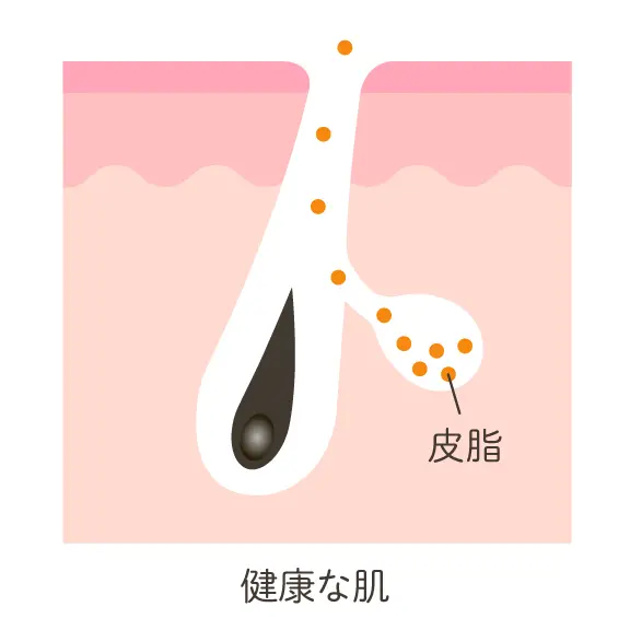 皮膚が正常な状態