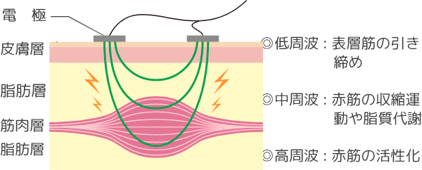 EMSのイメージ