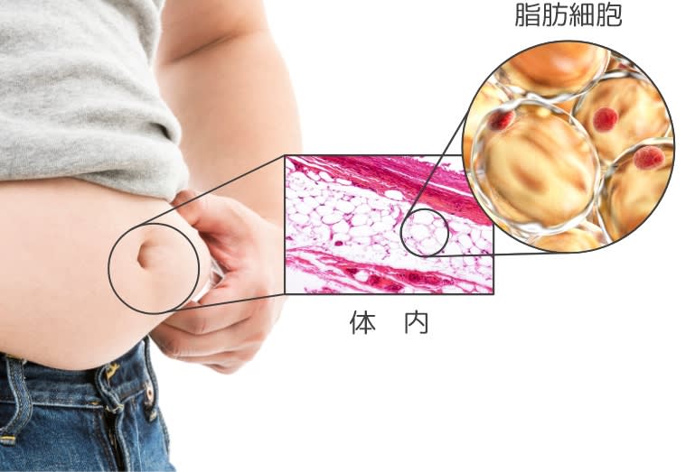 理想のボディに近づけない、カラダの不調など症状につながる可能性のイメージ