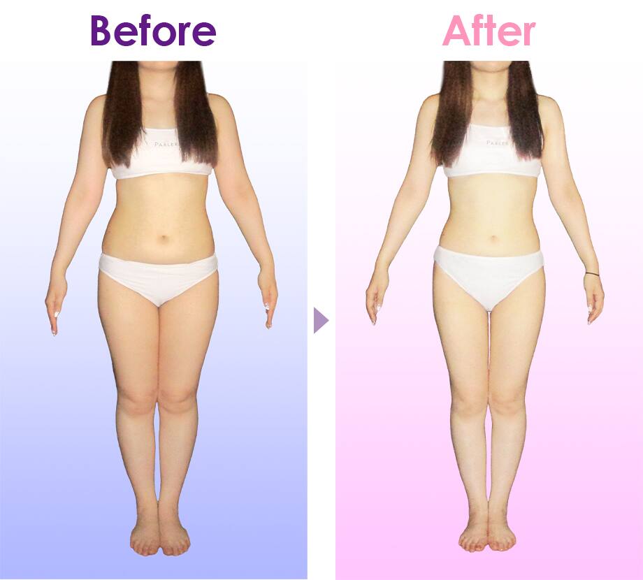 Before After イメージ1