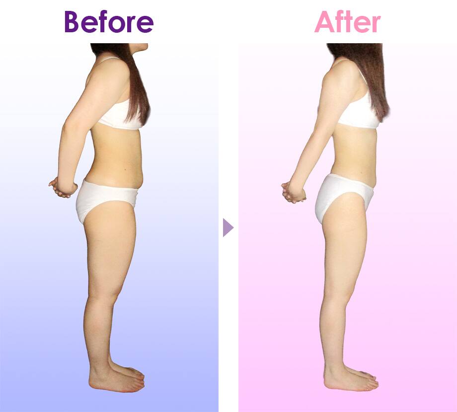 Before After イメージ2