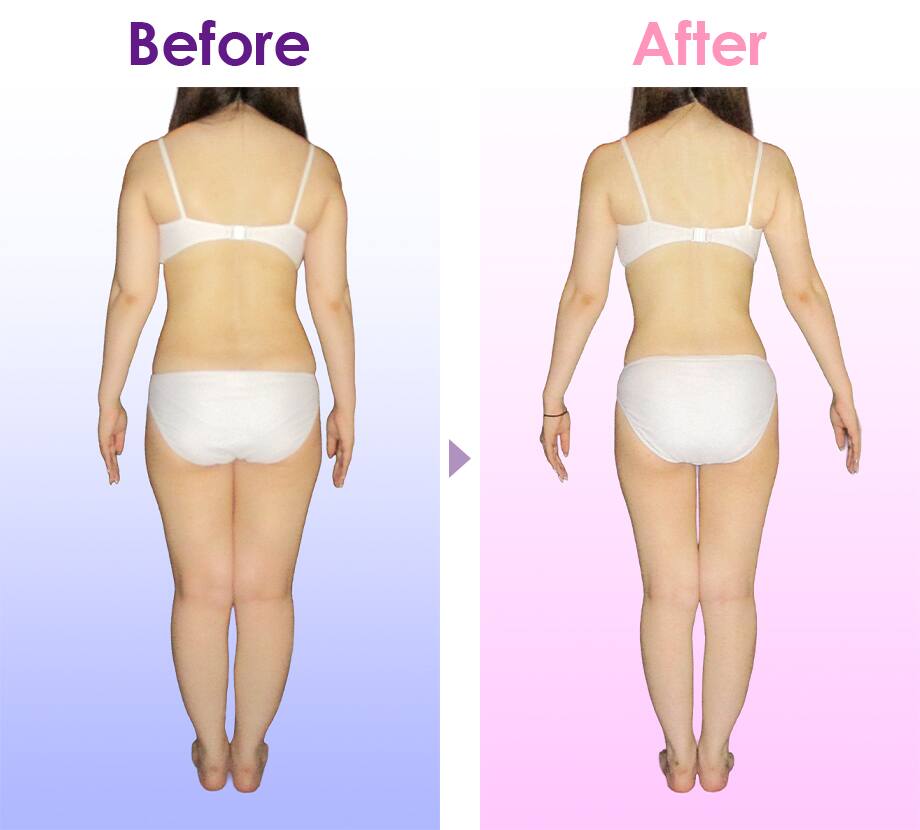 Before After イメージ3