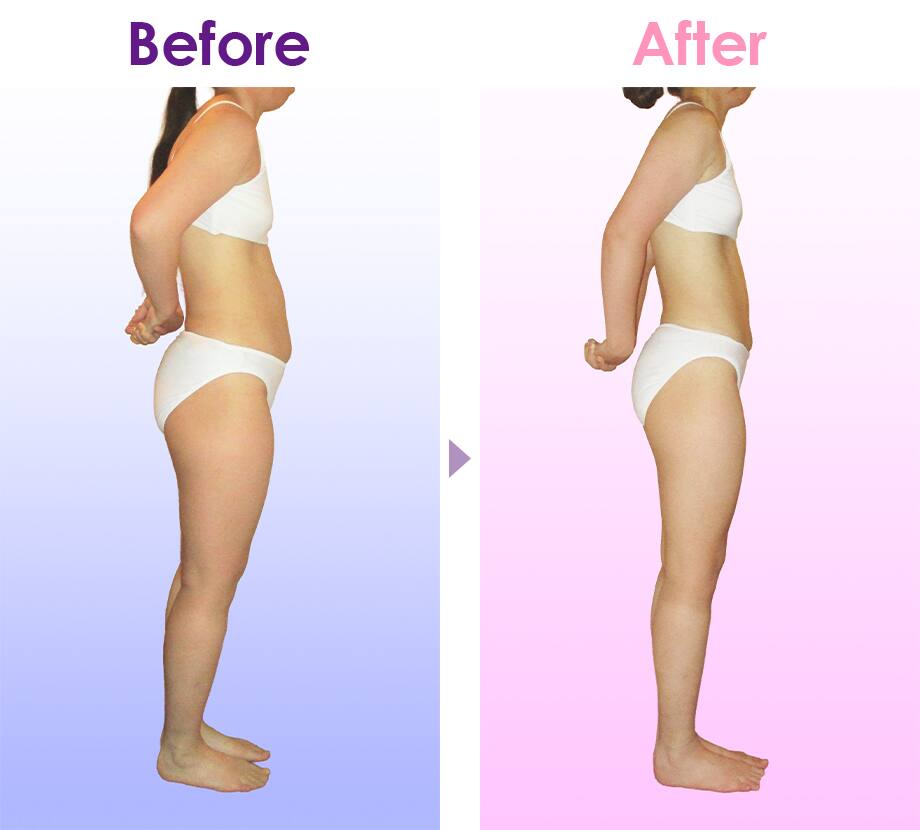 Before After イメージ2