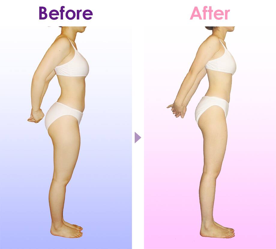 Before After イメージ2