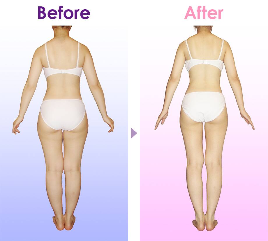 Before After イメージ3