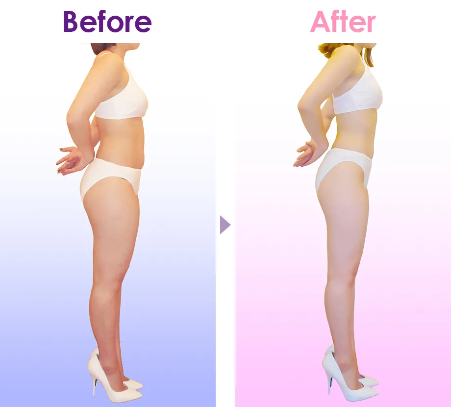 Before After イメージ2